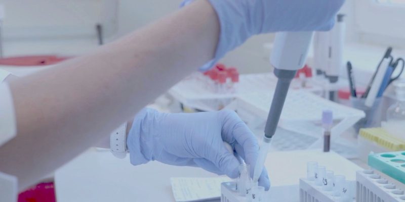 novas linhagens da Ômicron avançam e favorecem reinfecções