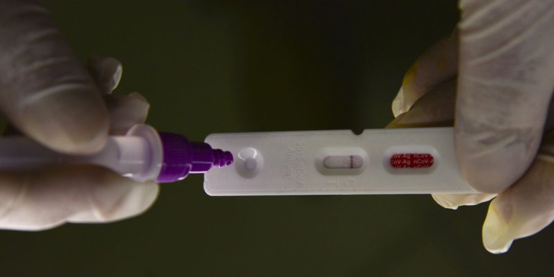 País registra casos de covid-19 e mortes em 24 horas