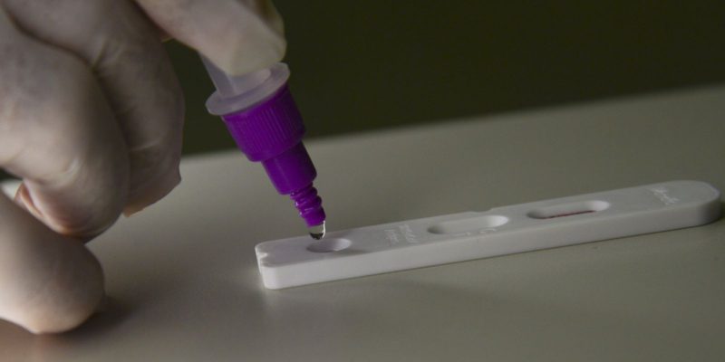 Brasil registra 38 mortes e 5,3 mil novos casos de covid-19