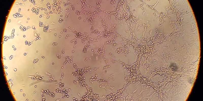 Praia Grande confirma morte de homem por varíola dos macacos