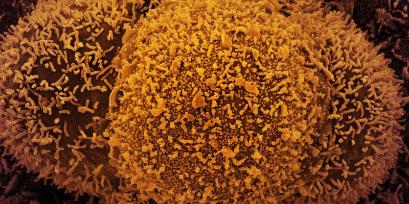 Fiocruz alerta para alta de casos de covid-19 em quatro estados