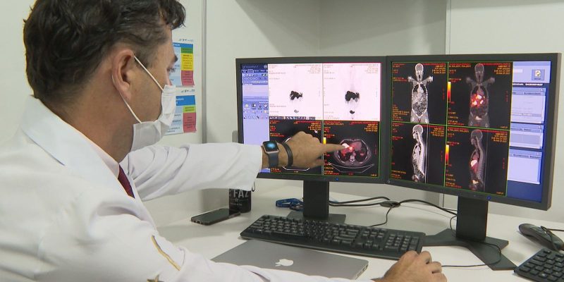 Inca prevê 44 mil casos novos de câncer colorretal no Brasil por ano