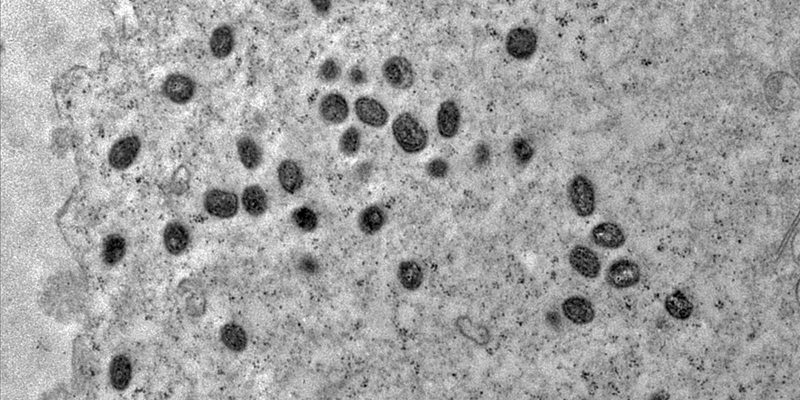 Mpox ainda é problema de saúde pública, dizem especialistas da Fiocruz
