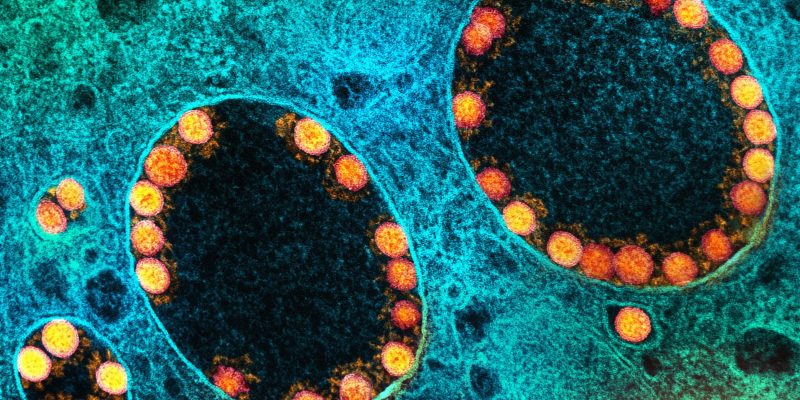 Fim da emergência de saúde pública foi acertada, avaliam especialistas