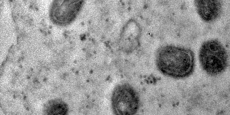 OMS declara fim da emergência em saúde por mpox