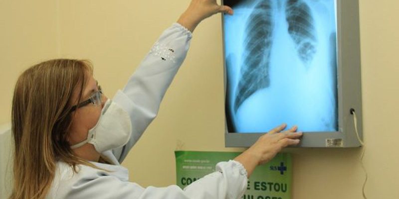 Brasil instala comitê interministerial para eliminação da tuberculose