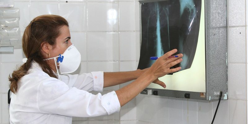 Governo cria comitê para reduzir casos de tuberculose até 2030