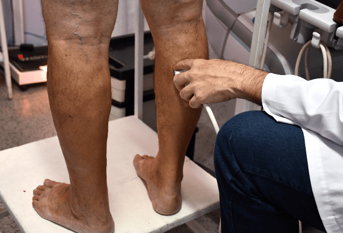 PREFEITURA DE RESENDE PROMOVE MUTIRÃO DE ULTRASSONOGRAFIA VASCULAR NESTE SÁBADO