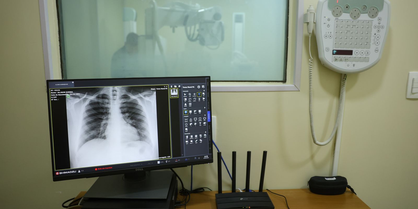 Brasil tem aumento de hospitalizações por Influenza A, alerta Fiocruz