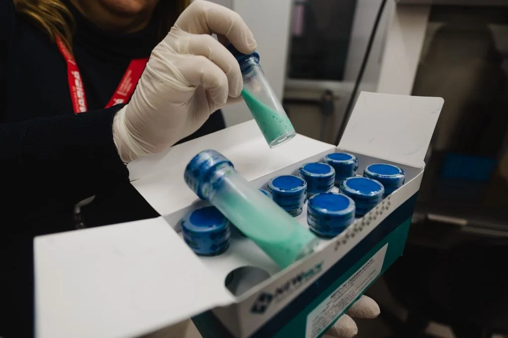 Maricá passa a realizar exames para diagnóstico da tuberculose no município